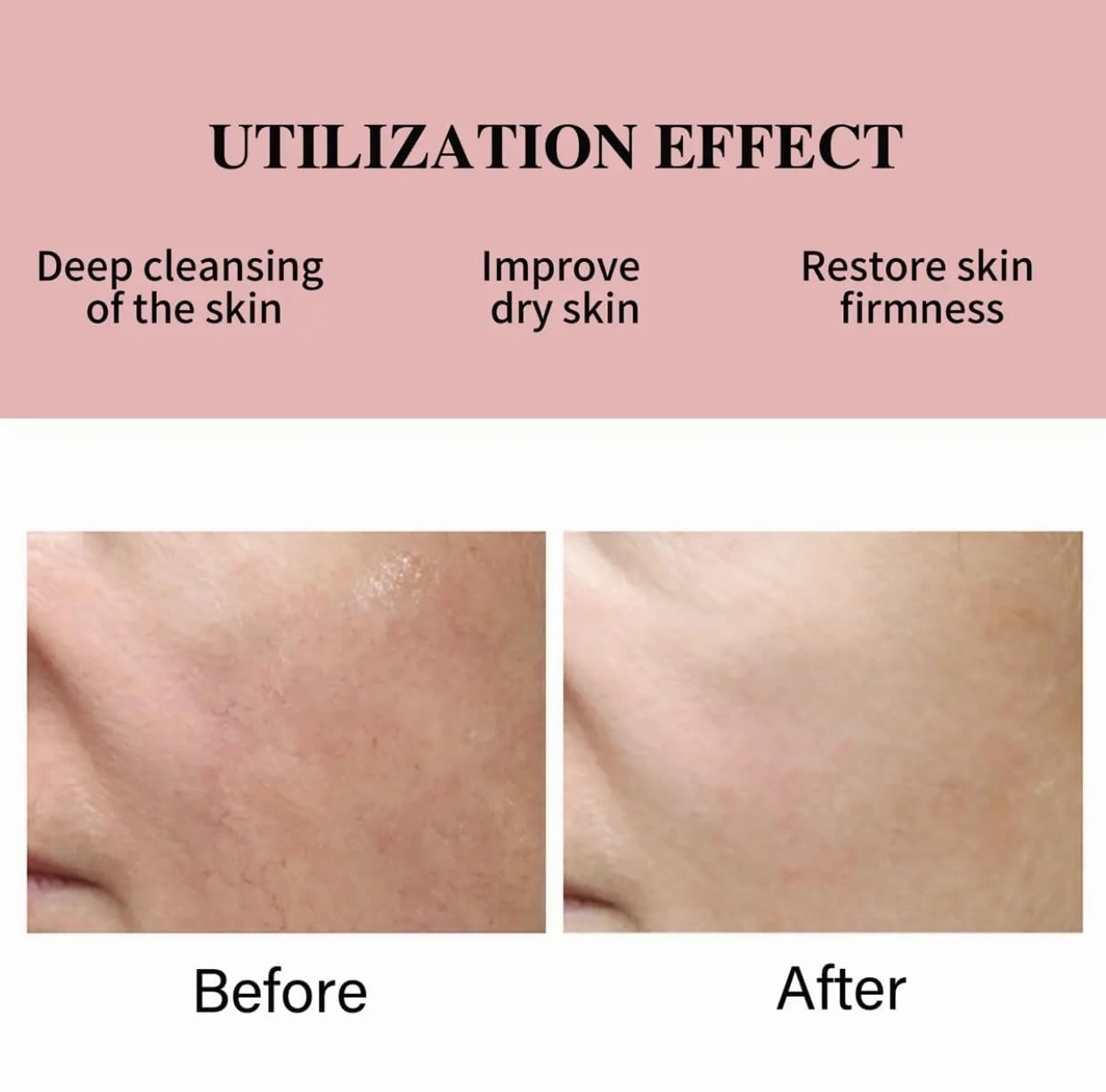5 in 1 Age Defense Cream Collagen, Vitamin E, C and Nicotinamide Vitamin B Anti Aging Facial Cream - Restoring, Smoothing & Hydrating - Reduces Fine Lines, Wrinkles, Dehydrated Skin & More.