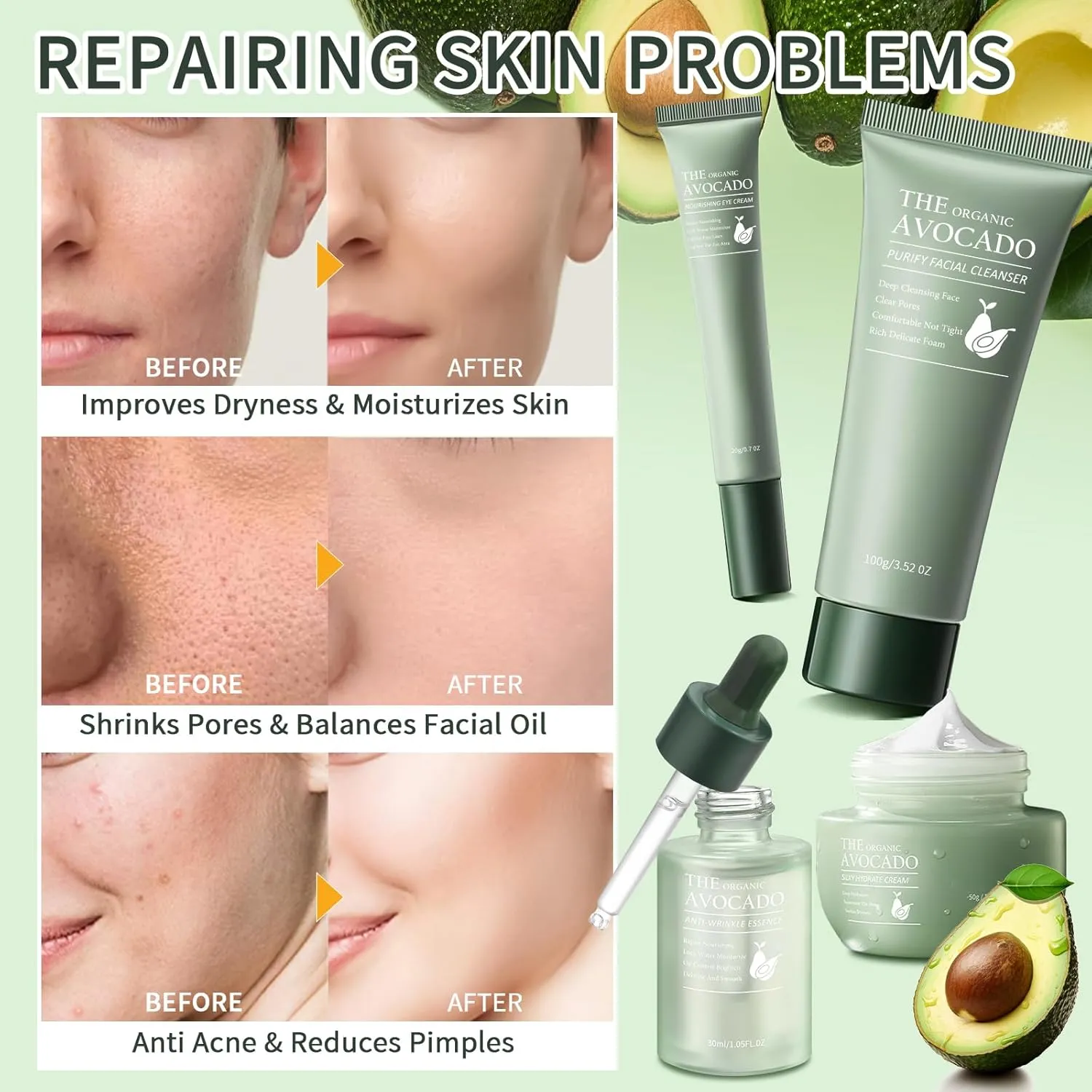 Avocado Skin Care Set, Skincare Gifts Kits For Hydrating Skin, Anti Aging Facial Kit For Women With Facial Cleanser, Toner, Face Serum, Lotion, Face Cream, Eye Cream. (6 Pieces)