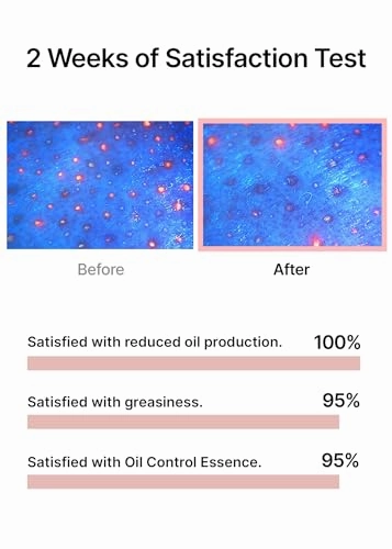 celimax Oil Control Capsule Essence | with Tea Tree Extract, For Sebum Reducing Serum, Mattifying, Hydrating, Moisturizing Mild Formula for Sensitive, 30ml