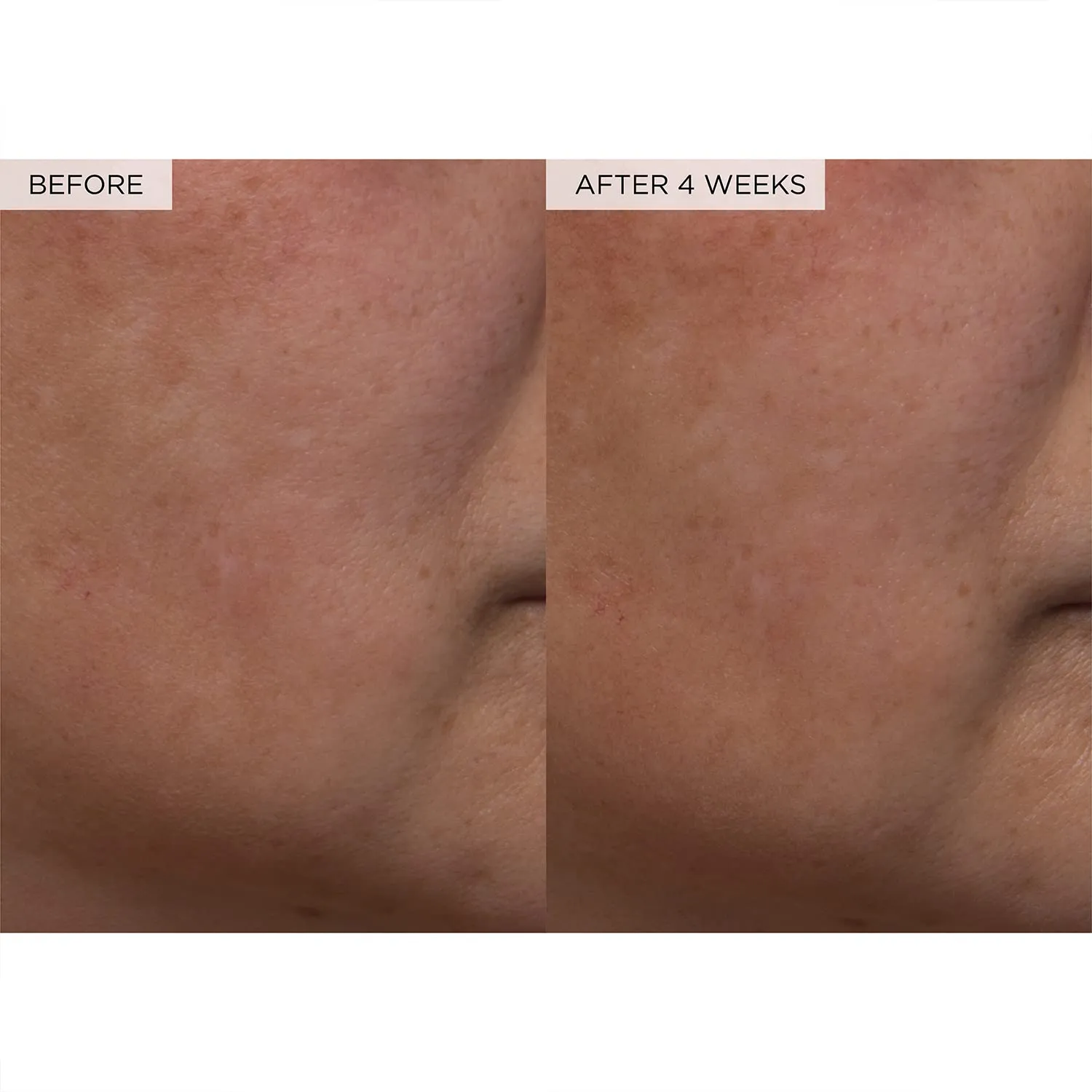 Glow Recipe PHA   BHA Face Toner - Korean Skin Care Pore Minimizer & Gentle Facial Exfoliator for Tightening, Hydrating & Exfoliating - Glycerin, Watermelon & Cactus Water (40ml)
