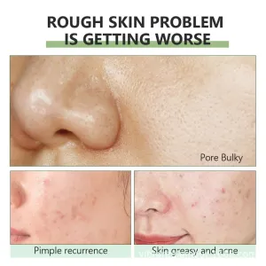 Herbal Pore Minimizing Serum,Pore Purifying Refining Serum,Smooth Skin Pore Refining Serum,Pore Minimizer For Face,Remove Blackheads And Shrink Pores (Size : 4Count (Pack of 4))