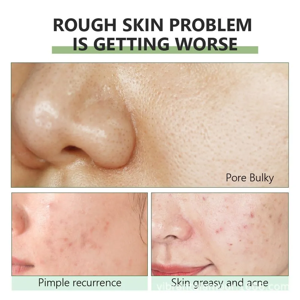 Herbal Pore Minimizing Serum,Pore Purifying Refining Serum,Smooth Skin Pore Refining Serum,Pore Minimizer For Face,Remove Blackheads And Shrink Pores (Size : 4Count (Pack of 4))