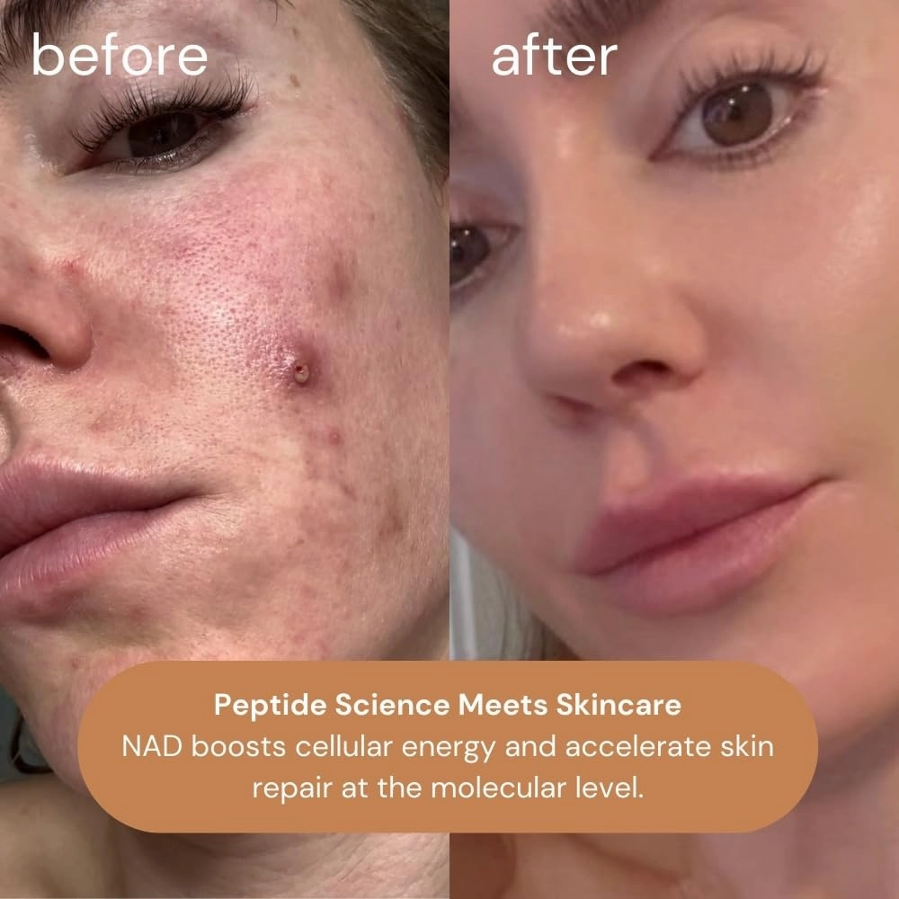KOA Life NAD Peptide Facial Daily Anti-Aging Serum. in a Metallic Copper Glass Dropper Bottle and Metallic Copper Outer Cylinder Carton