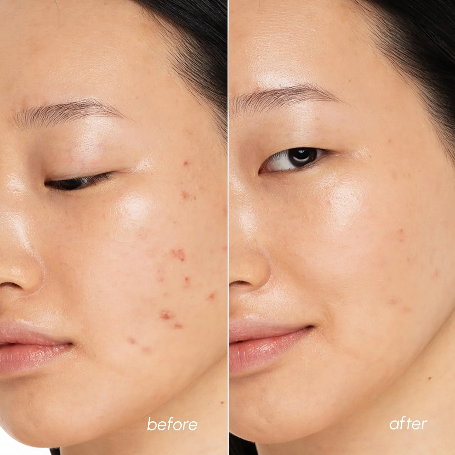 MAREE Blemish Toner Polishes - Daily Facial Radiance Toner Polishes - Witch Hazel Acne Face Toning Pads - Acne Skin Care with BHA Salicylic Acid - Cleansing Pad for Face - Blemish Clearing Wipes