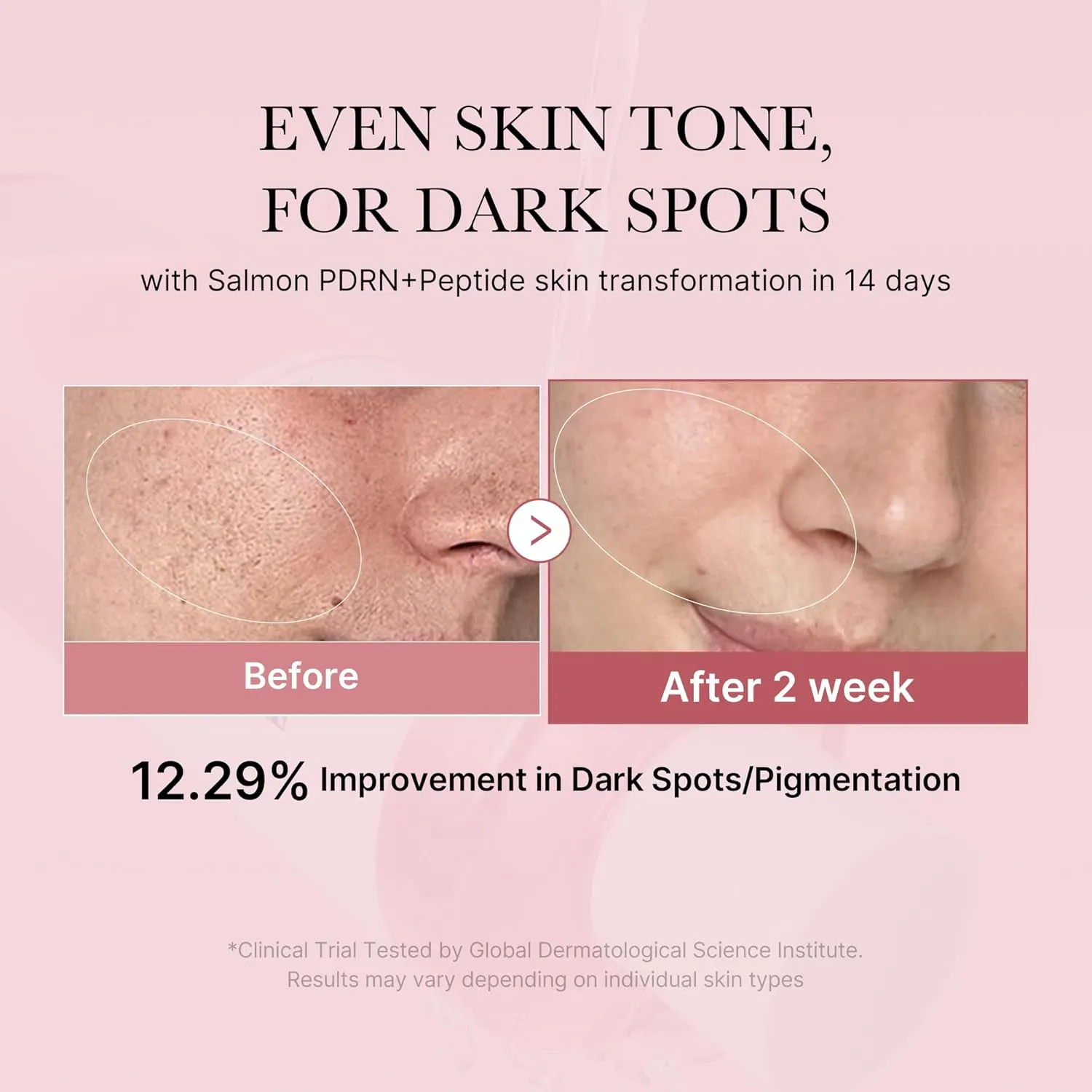 medicube Salmon DNA PDRN Pink CICA Soothing Toner I Pink Glow Toner for Skin Boosting, Soothing and Calming, Uneven Skin Tone, Peptide & Niacinamide, Korean Skin Care (250ml / 8.45 fl. oz.)