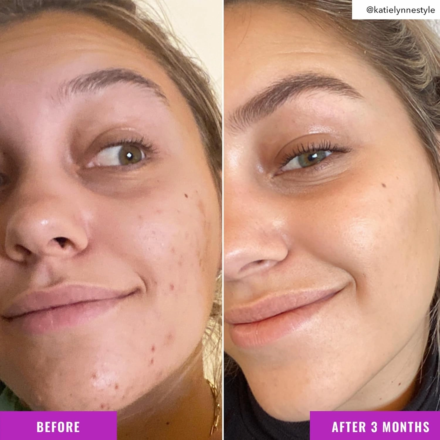 Niacinamide Brightening Toner - Facial Toner with Niacinamide, Vitamin C and Arbutin for Even Tone, Enlarged Pores - Skincare for Face
