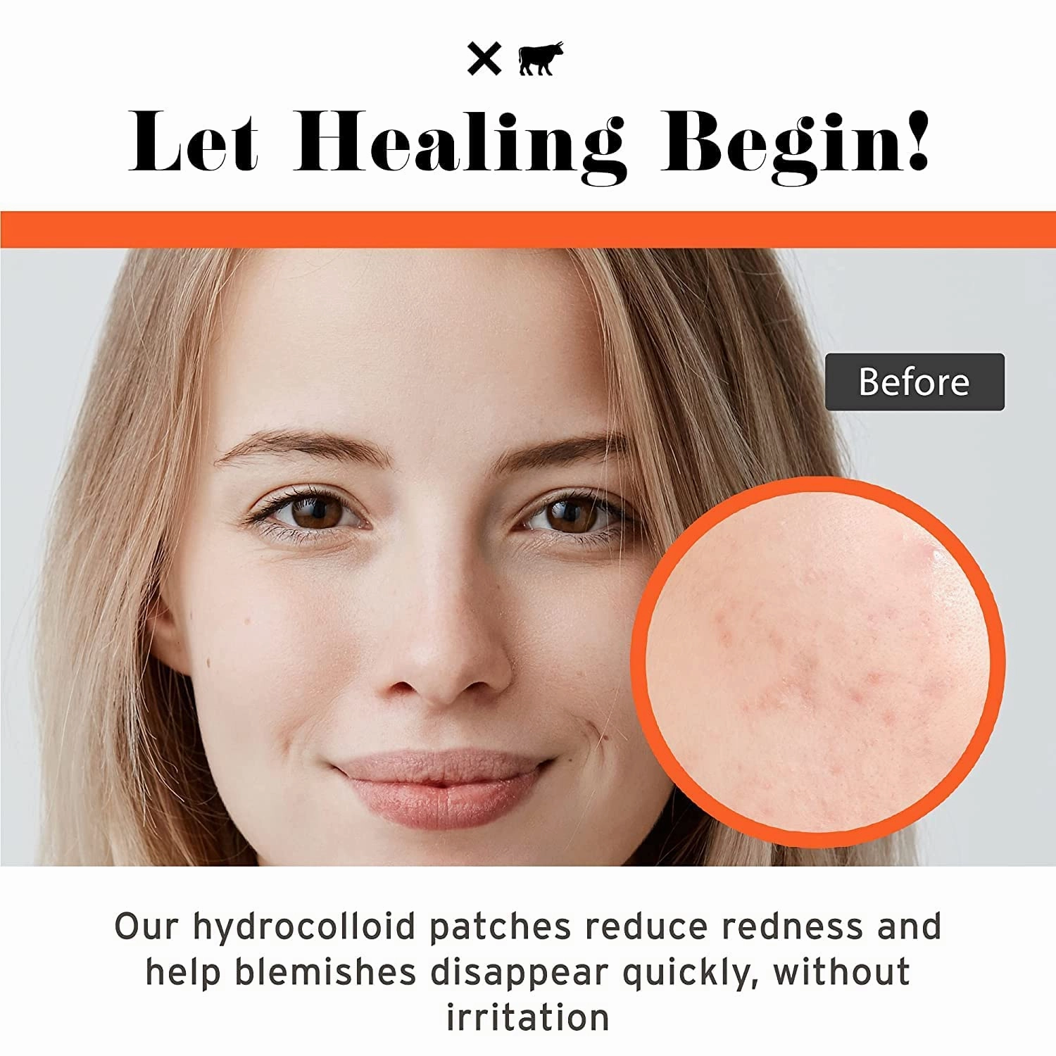 No Bad Stuff - Healing Acne Patches with Hydrocolloid, Waterproof, Invisible Pimple Patches, Wear Under Makeup & Sunscreen, Acne Skin Care for Women & Men, Spot Patches for Pimples, 72 CT