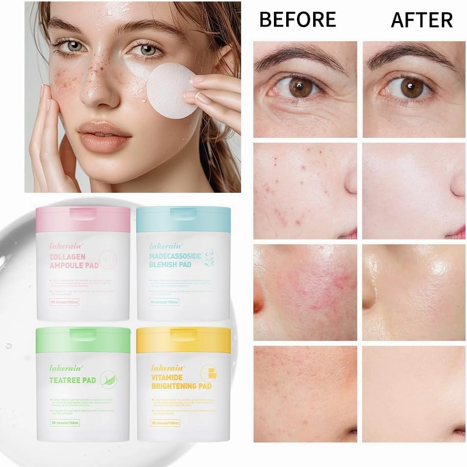 Salicylic Acid Toner | Deep Hydrating Makeup | Soothe Redness After Sun Exposure | Acne with Compress | Refreshing Toner Application Cotton Pads (Yellow)