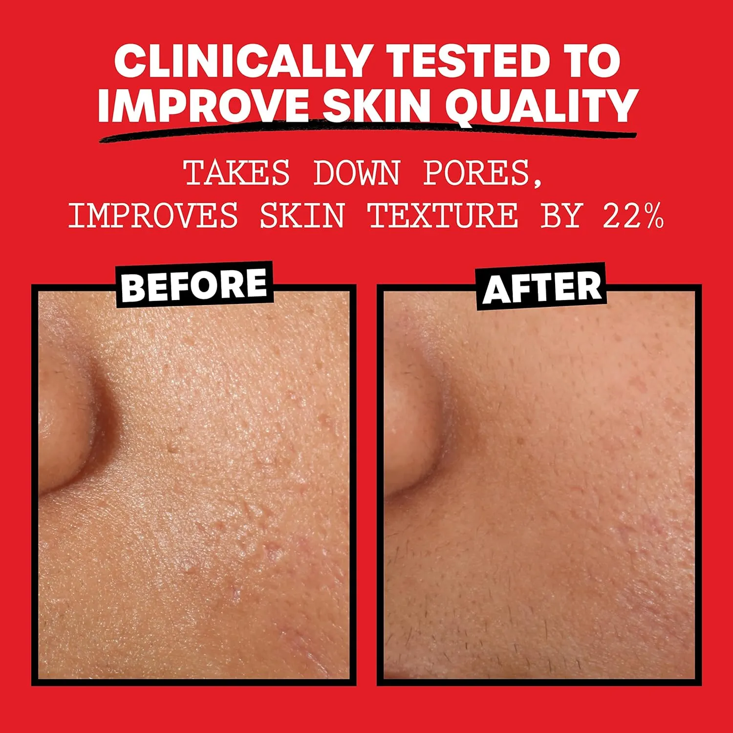 THAYERS Alcohol-Free, Hydrating Rose Petal Witch Hazel Facial Toner with Aloe Vera Formula, Vegan, Dermatologist Tested and Recommended, 12 Oz (Pack of 2)