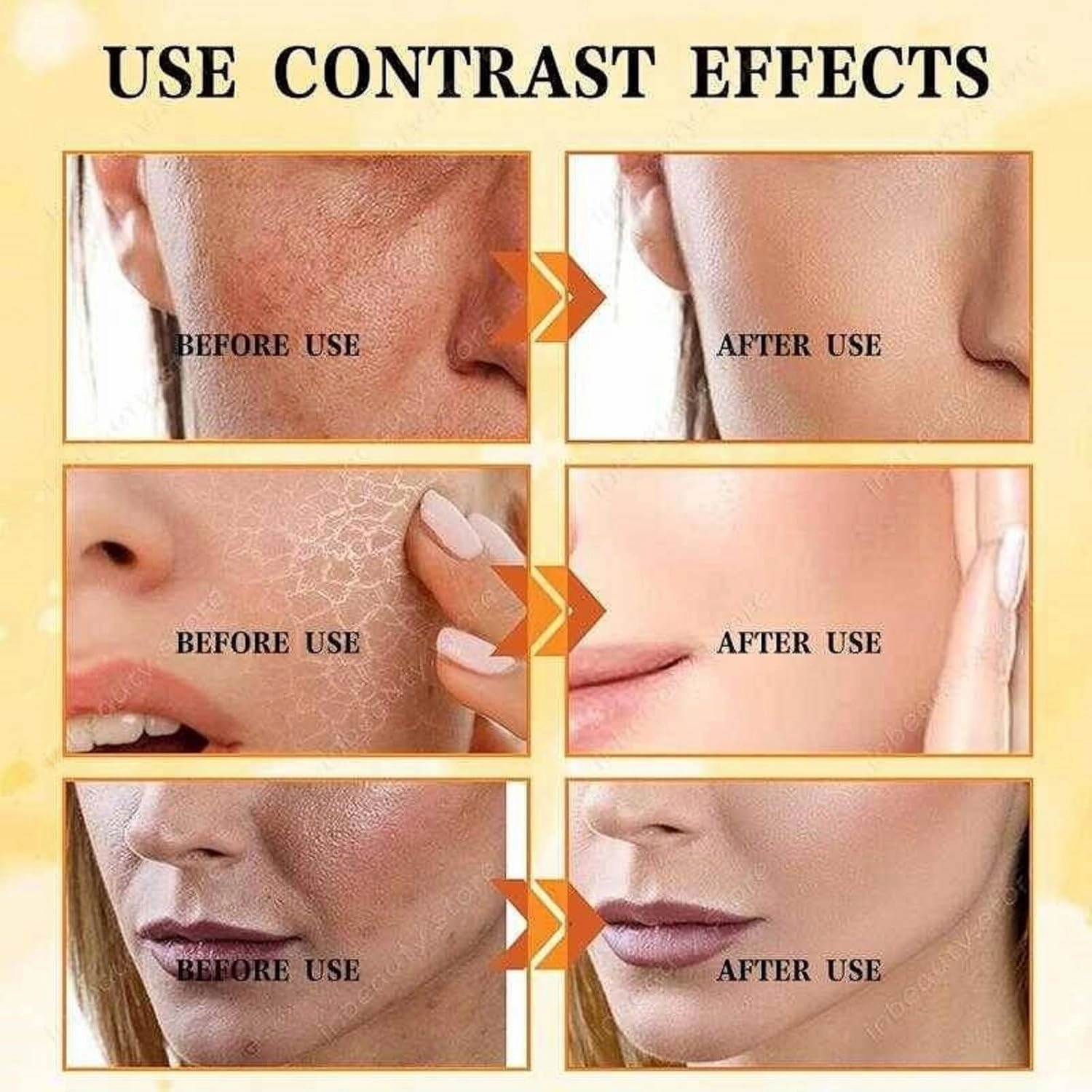VC Toner - VC Toner Korean, Kniyea 𝐕𝐂 Soothing 𝐓𝐨𝐧𝐞𝐫, 𝐕𝐂 𝐓𝐨𝐧𝐞𝐫 Intensive Whitening, Vitamin C Moisturizing Toners,Refreshing Hydrating,Minimises Pores & Soothes Dry Skin (300ml)