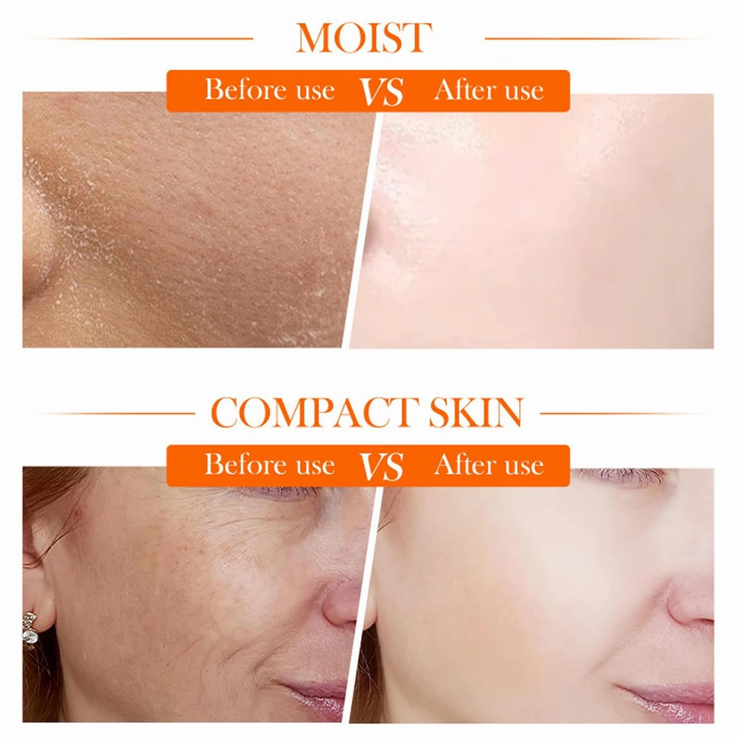 Vitamin C Toner, vitamin c serum, Vitamin C Skincare Kit, Skin Hydration, Skin Texture Support, Includes Toner, Serum, Moisturizer, Cream, Unique Gift for Women/Mom (1 Set)