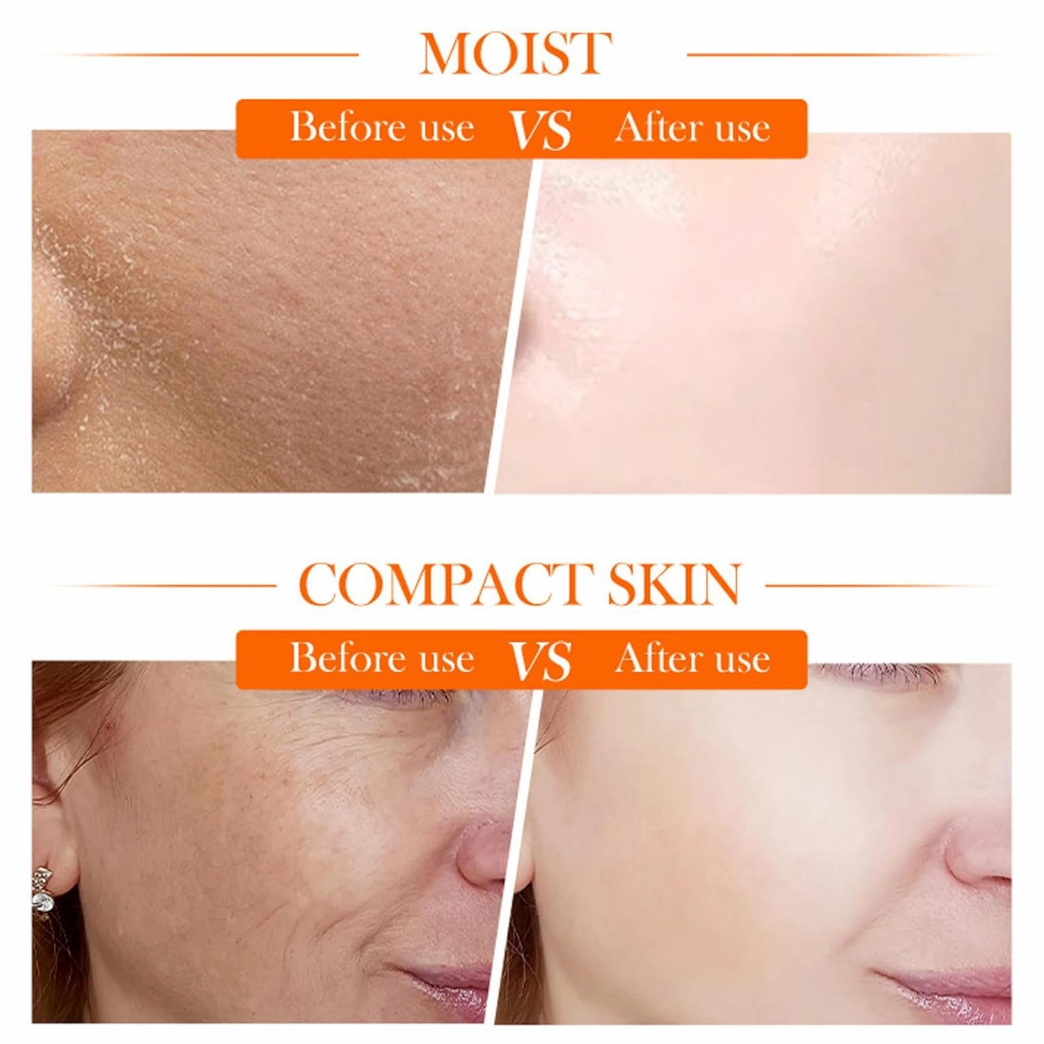 Vitamin C Toner, vitamin c serum, Vitamin C Skincare Kit, Skin Hydration, Skin Texture Support, Includes Toner, Serum, Moisturizer, Cream, Unique Gift for Women/Mom (Lotion Cream serums)